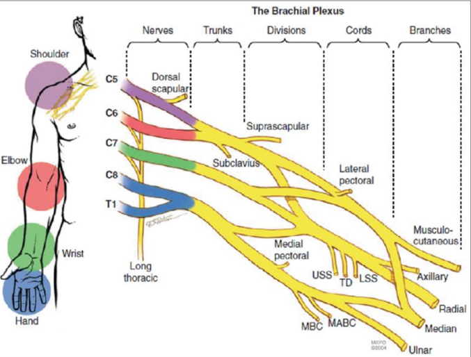 Adult Brachial Plexus Injuries